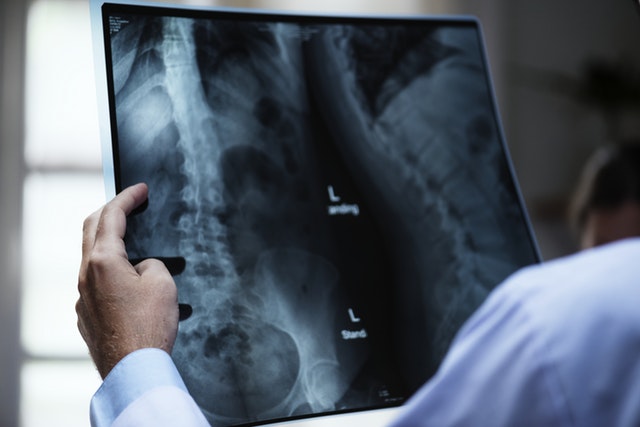 4 More Surprising Benefits Of Vitamin K-2