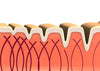 All about Collagen