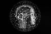 How Alpha-GPC Might Improve Memory, Focus, and Exercise Performance