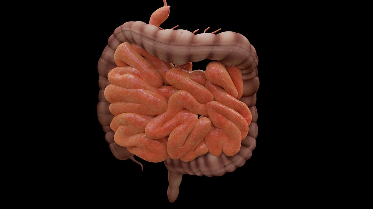 Could SIBO Be Behind Your Symptoms?